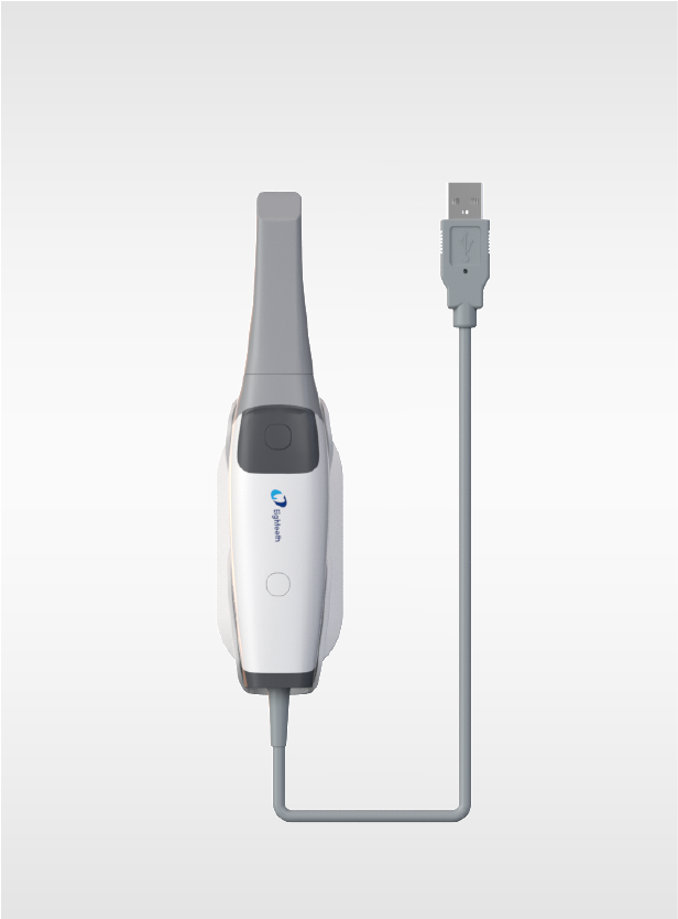 Intraoral Scanner